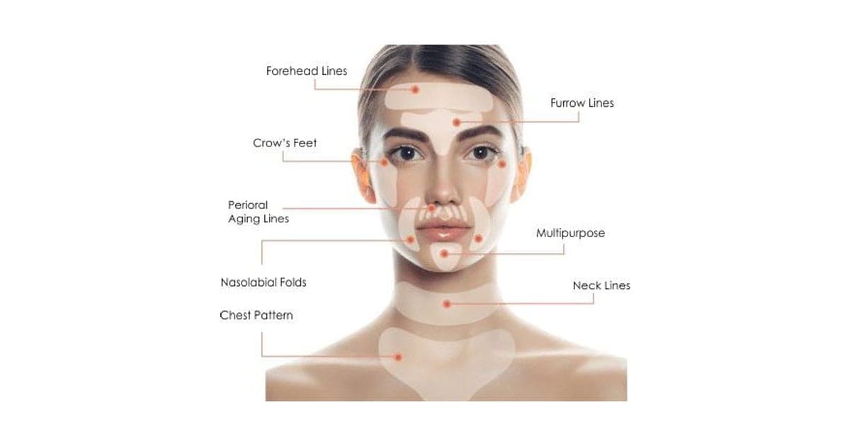 Face diagram showing where ByeWrinkle Pro silicone pads go: forehead, between the brows, crow's feet, around the mouth, neck and chest