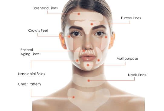 Woman's face and chest with outlines of clear ByeWrinkle Pro pads labelled forehead lines, furrow lines, crow's feet, perioral lines, nasolabial folds, neck lines and chest pattern