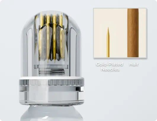 Close-up of the Glamory microneedle head showing rows of gold-plated needles compared with a hair