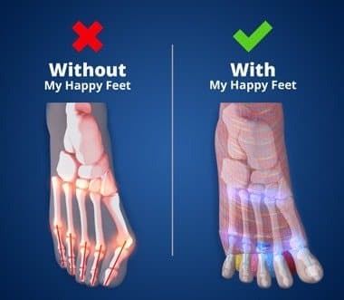Marketing illustration comparing foot bones without and with My Happy Feet Socks