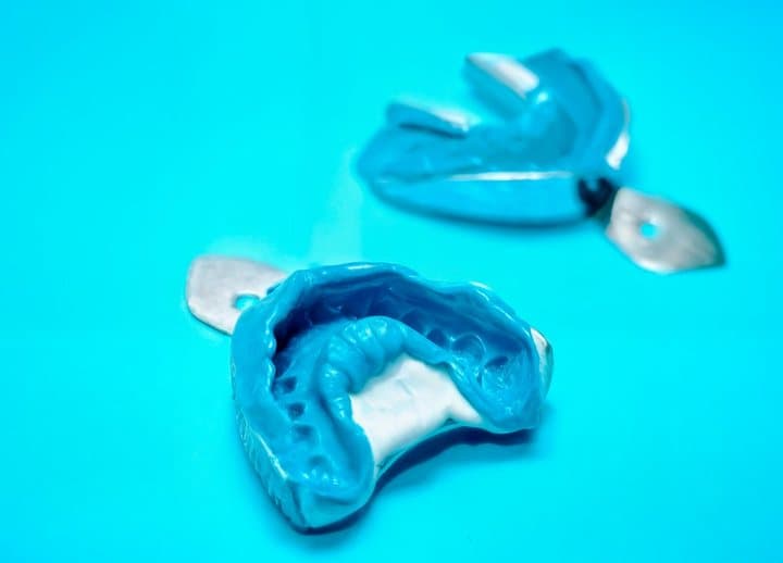 Blue dental impression trays with putty used for making Shiny Smile moulds