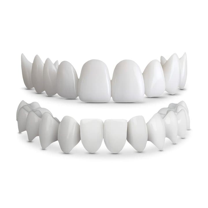 Close-up of Shiny Smile upper and lower veneers showing their shape