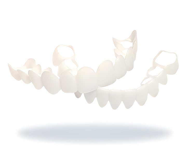 Upper and lower Shiny Smile snap-on veneers on a white background