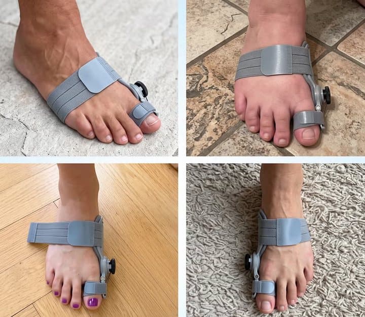 Four photos of feet wearing the Treatmedy Bunion Fix on different floors