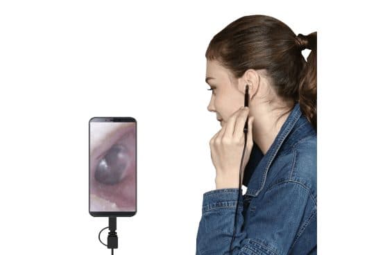 Smartphone showing a close-up of an ear canal and eardrum, connected by cable to a slim black probe a woman holds at her ear