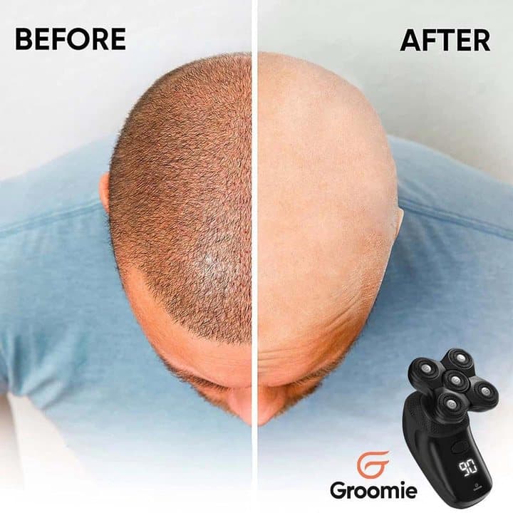 Before and after photos of the back of a man's head going from thinning hair to fully shaved
