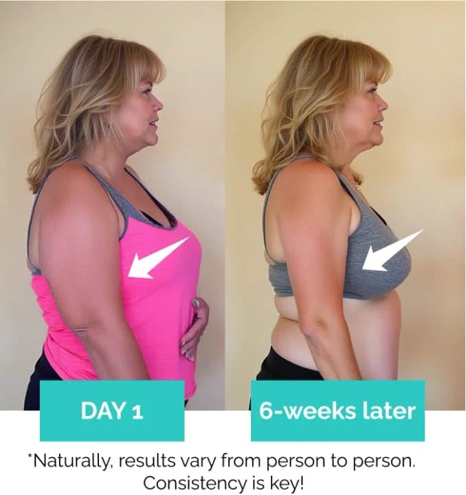 Seller's before and after photos of a woman's arms labelled day 1 and 6 weeks later