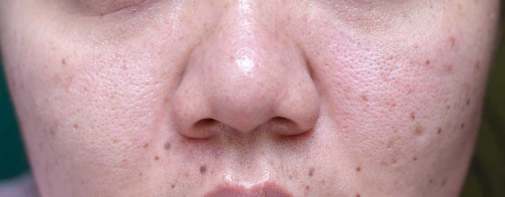 Top 10 Best Dead Sea Mud Masks - Buyer's Guide 5 Minimizes Pores