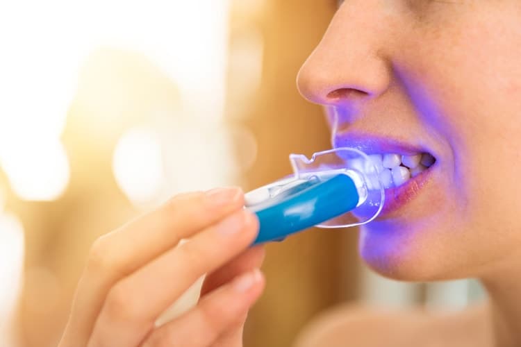 How does LED Teeth Whitening work?