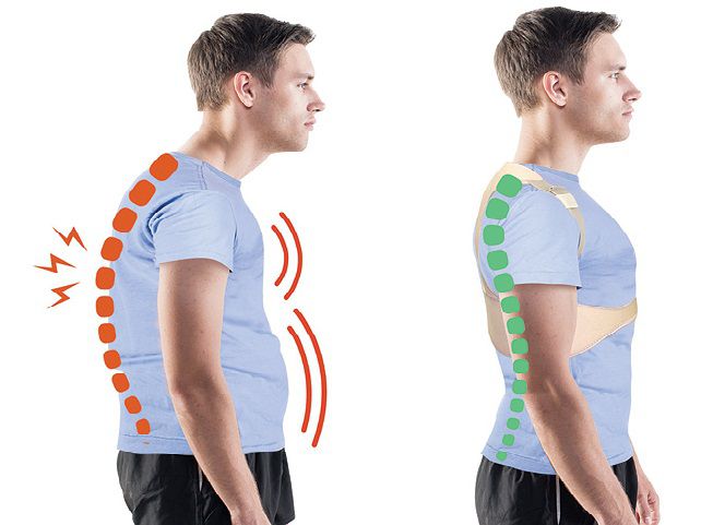 Who should wear a posture corrector?