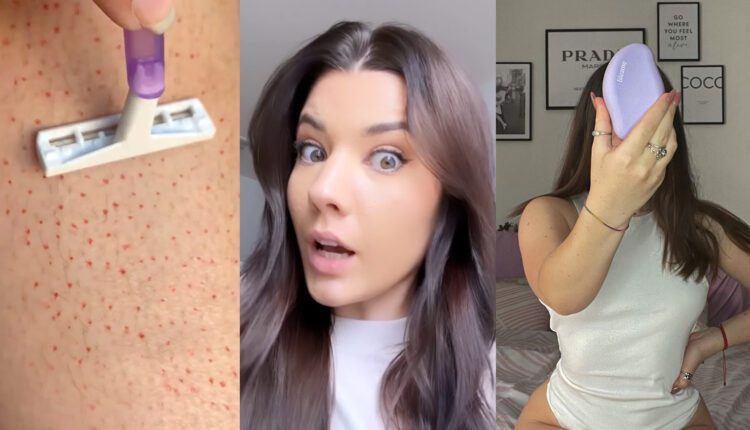 Bleame Hair Eraser Review